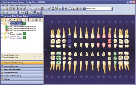 Dentrix Mobile Simplified