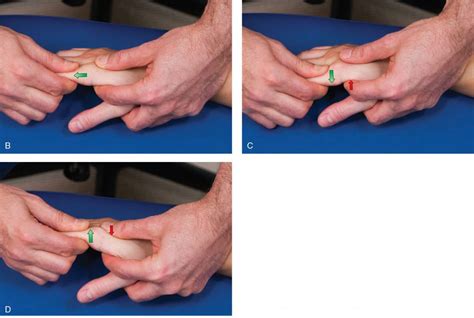 External Mobilization Occurs When External Mobilization Occurs When